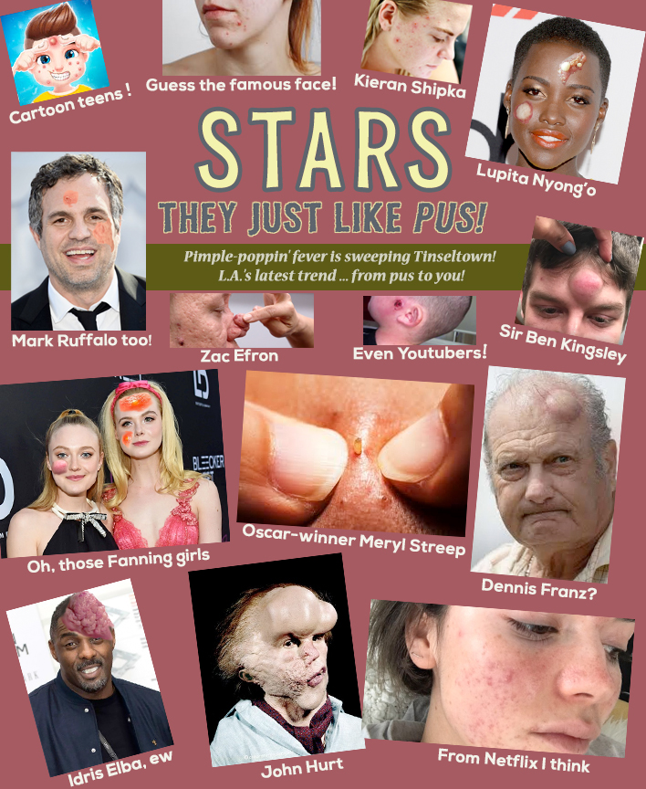 Stars: They Just Like Pus!